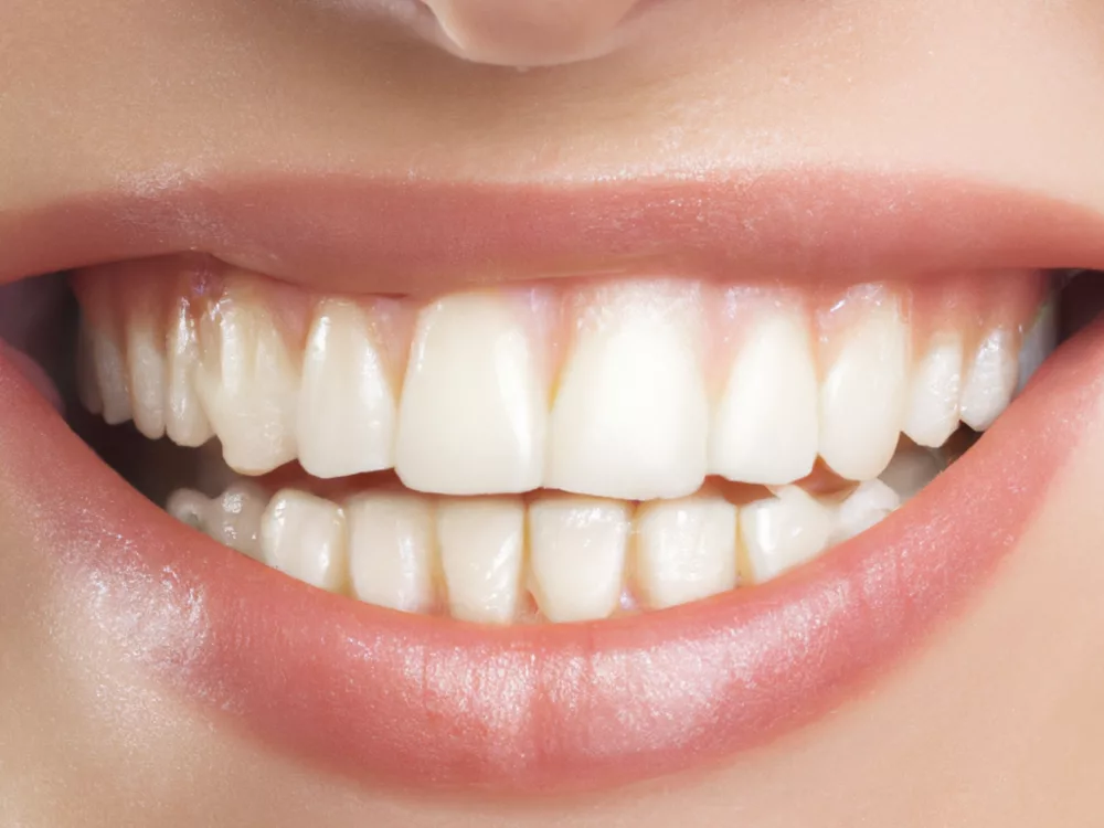 Navigating Dental Costs: A Comprehensive Look at CareCredit for Your Oral Health